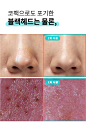 [W CONCEPT] : [FACE FACTORY 페이스팩토리] 각질 피지관리 아쿠아 제로필링기