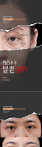 医美眼部年轻化海报-源文件