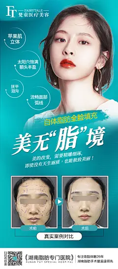 脂肪填充海报-素材库-sucai1.cn
