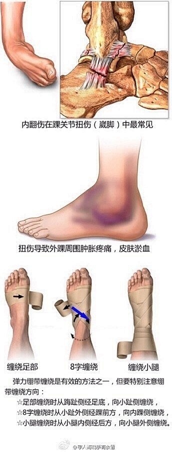 踢足球打篮球的都注意一下。如果要是导致了...