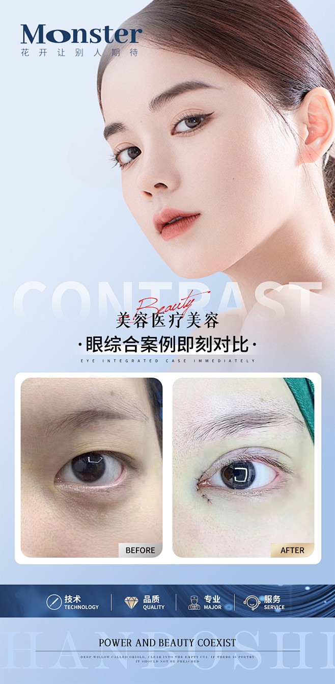 医美眼案例宣传海报-志设网-zs9.co...