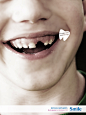 Dental Implants - Smile - It's only cute when you're young | Adland ®