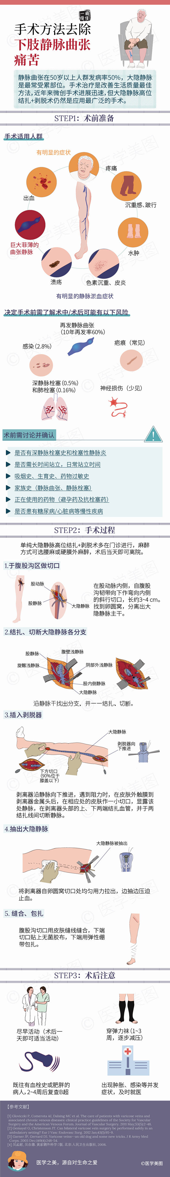 简单三步丨手术方法去除下肢静脉曲张痛苦
