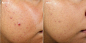 clarifying oil-free water gel BnA Image 1