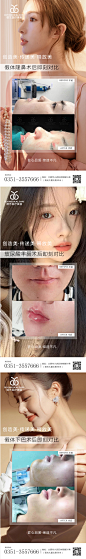 医美案例对比海报-素材库-sucai1.cn