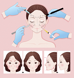 Somnus樱采集到医美插画