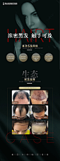 【源文件下载】易拉宝 X展架 医美 美容 植发 头发,设计作品集