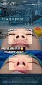 淘宝【樱桃设计素材】海报 医美 案例 对比图3
