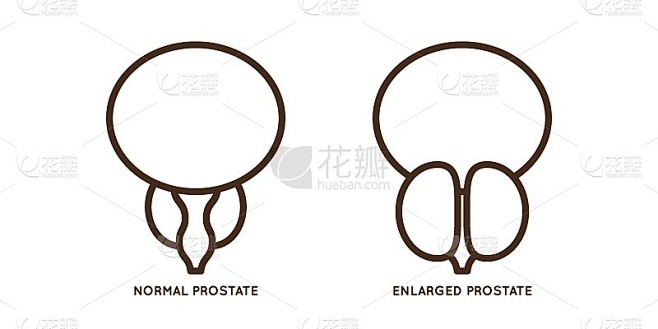 男性前列腺疾病载体图标平面插图