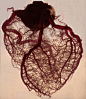 【标本雕塑】Rob Jones - 《Anatomical Heart》, 2007。一颗被剥离了脂肪和肌肉组织的心脏标本。