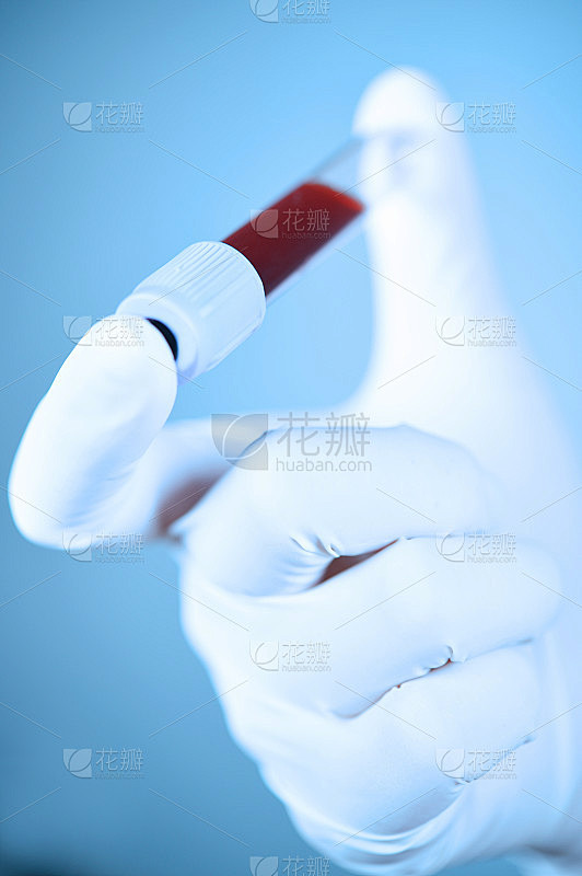 试管中的血液用蓝色滤镜取血