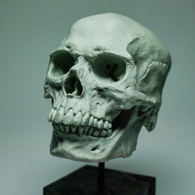 The skull