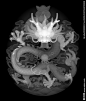 云龙 正龙 盘龙 龙头
