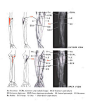 【学人体】男性手臂肌肉块与骨骼~~~（相关微博：http://t.cn/8kidQsn ）