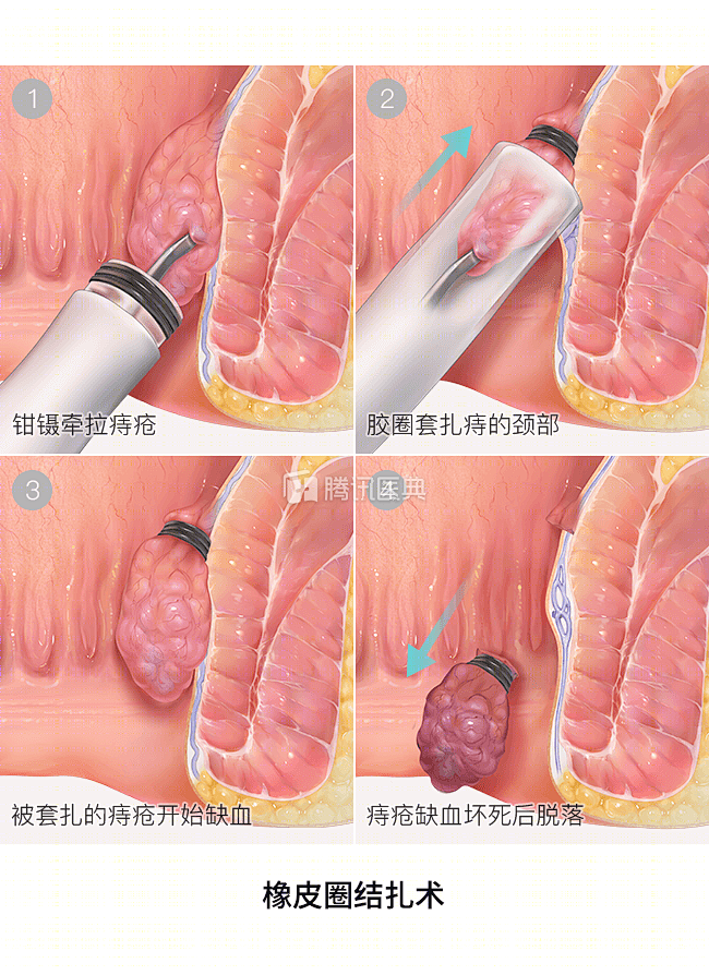 腾讯医典