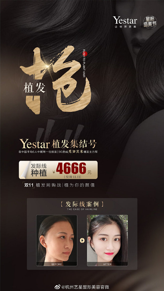 Yestar植发集结号
双11植网购战
...