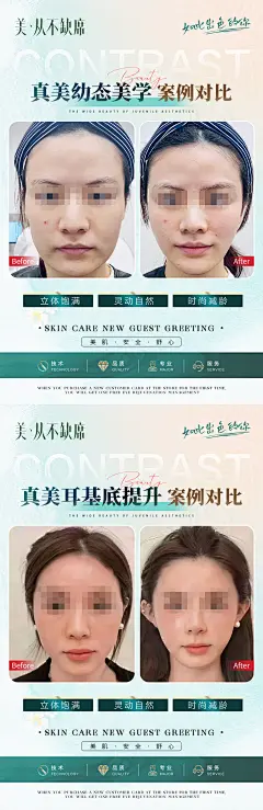 【素材能量站】海报 医美 人物 邀请函 系列 皮肤管理 美业 沙龙 幼态脸 眼周 口腔 耳基底 提升 案例对比 |1029558 
