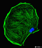 细胞骨架（Cytoskeleton）一般是指细胞内细胞质中的由蛋白质构成的纤维的网络结构。细胞骨架不仅在维持细胞形态，承受外力、保持细胞内部结构的有序性方面起重要作用，而且还参与许多重要的生命活动，如：在细胞分裂中细胞骨架牵引染色体分离，在细胞物质运输中，各类小泡和细胞器可沿着细胞骨架定向转运；在肌肉细胞中，细胞骨架和它的结合蛋白组成动力系统；在白细胞（白血球）的迁移、精子的游动、神经细胞轴突和树突的伸展等方面都与细胞骨架有关。另外，在植物细胞中细胞骨架指导细胞壁的合成。