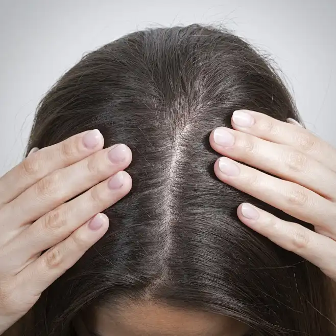 healthy-scalp-close-up-istock-min-花瓣网