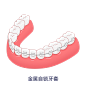 牙套正畸牙齿矫正材料种类-金属自锁牙套