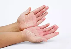 白色背景,部分,手,干的,粗糙的图片ID:VCG41N931634378