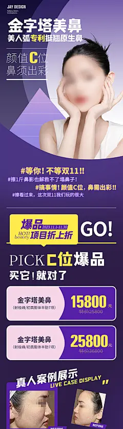 医美隆鼻活动海报-源文件