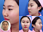 柳州华美整形美容