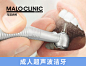 马泷齿科口腔超声波洁牙洗牙卡冲牙清洁洗白去黄牙垢牙结石清除-tmall.com天猫