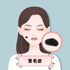 一颗榛果采集到医疗插画