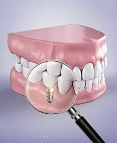 关爱牙齿海报设计-赞设计