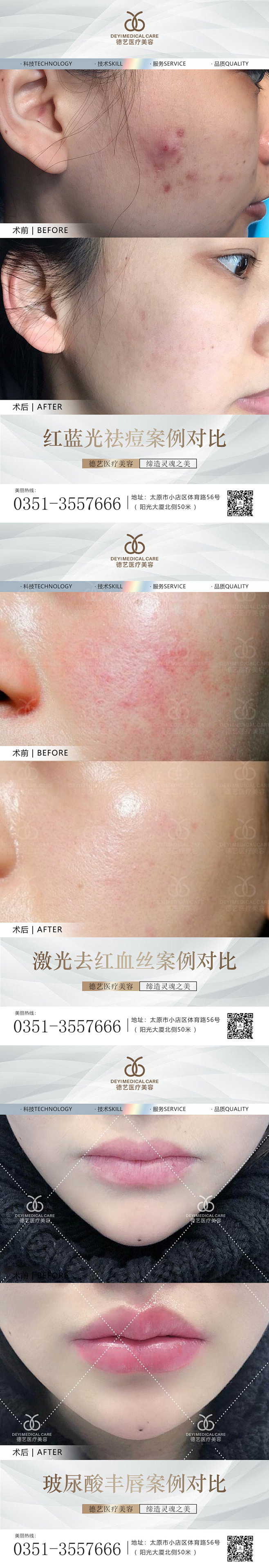 医美案例对比图-素材库-sucai1.c...
