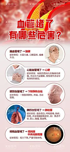 血管堵了有那些危害宣传海报  - 源文件下载【酷图网】海报,医疗,心梗,脑梗,高血压,医疗,西医,血管,宣传,