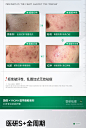愈创木祛痘精华原液痘印痘坑修复淡化痘疤去闭口粉刺黑头收缩毛孔-tmall.com天猫