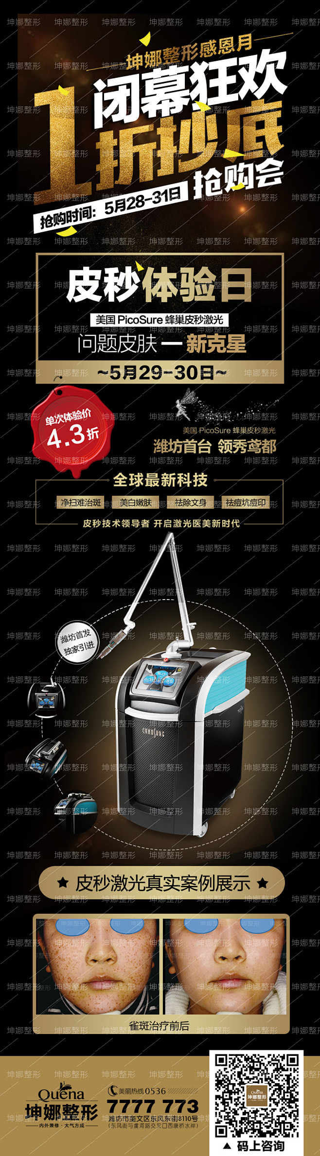 皮秒   坤娜整形   皮秒单图   皮...