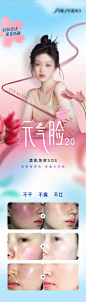 源文件下载【医美敏感肌案例海报】编号：20230710105841818