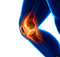 膝盖痛png (5)