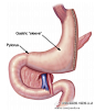 减肥手术对骨代谢的影响。 The Effects of Bariatric Surgery on Bone Metabolism. 【论文医学插画欣赏】国内外文献全文可以为您免费传递！QQ 18147895 活动详情见 O网页链接 ★★★ 喜欢 医学插画 医学美图 医学插图 医学美术 医学可视化 医学插画师 医学动画 请关注我。★★★请前往高能区 ​​​​...展开全文c