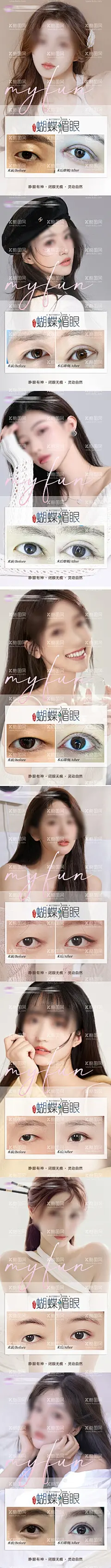 蝴蝶媚眼医美系列海报  - 源文件下载【酷图网】海报,医美,整形,眼睛,美眼,眼综合,蝴蝶媚眼,案例,对比,人物,系列,