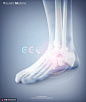 脚部骨骼诊疗数据测试数据医疗海报 海报招贴 医疗药品
