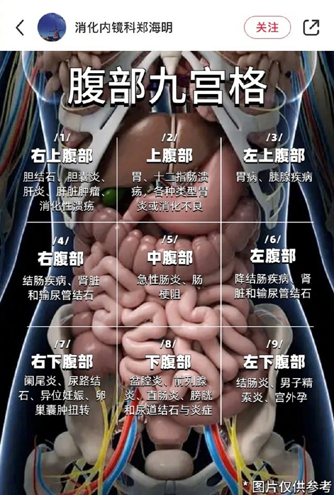 ：肚子痛到底是哪里痛？一张图让你自查☝️ ⚠️不同部位腹痛可能代表不同病症，图片仅供参考 