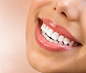 Maintenance for Your Invisalign Aligners