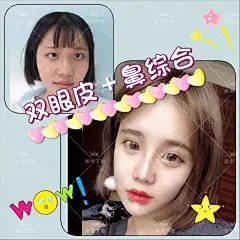 2800+医美整形案例对比图视频-图片#美女模特#前后对比#整形案例