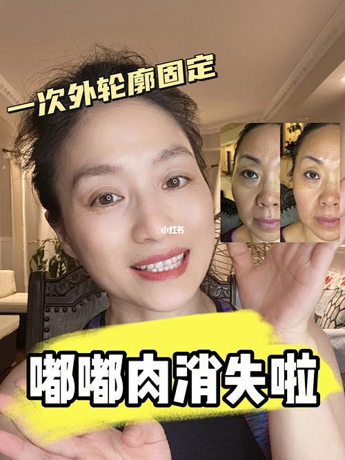 轮廓固定_百度图片搜索