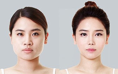 瘦脸对比图_360图片