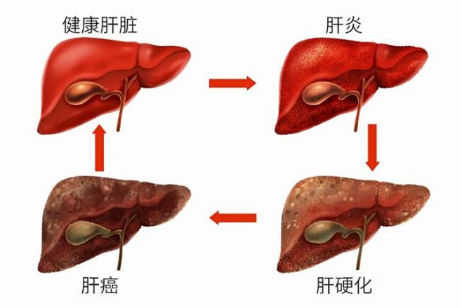 扶正抗纤 - 知乎 : 致力于为大家提供...