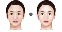 美学设计少女采集到对比图