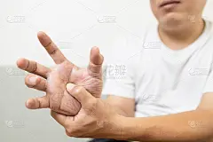 亚洲中年男性患者患有手部麻木疼痛，关节炎，肌腱问题引起手指抽搐，触发手指疾病，关节僵硬，按摩他的手掌