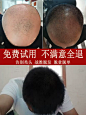 生姜王洗发水男女老姜王头发增长液防脱发严重生发增发密发掉育发-tmall.com天猫