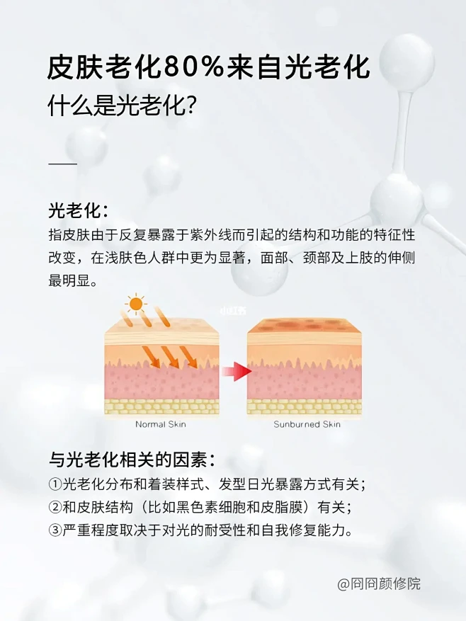 每天一个护肤知识|皮肤老化80%来自光老化