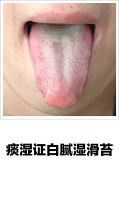 阿宅学医记采集到舌诊图